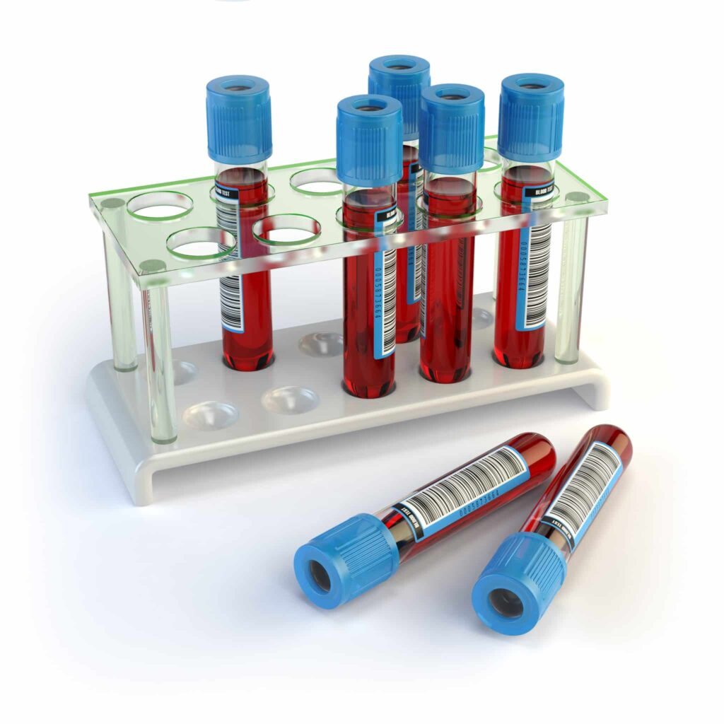 Serology-based tests for COVID-19 Laraway Family Dentistry