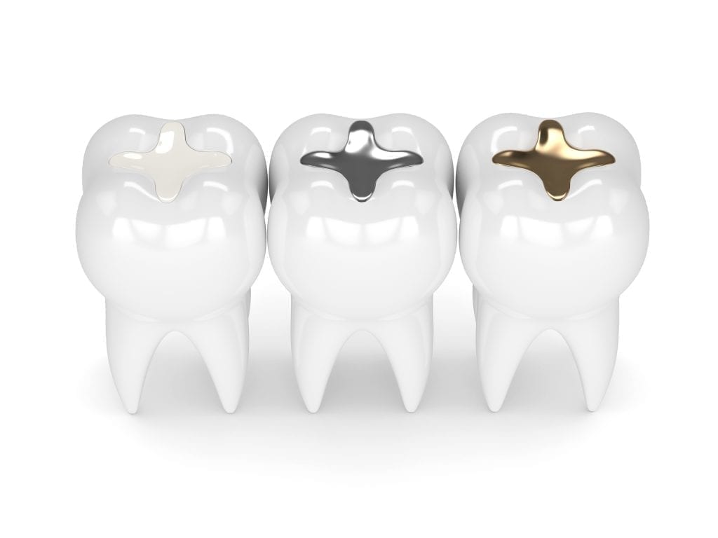 Recommendations for Certain High-Risk Groups Regarding Mercury-Containing Dental Amalgam Laraway Family Dentistry in Conroe, TX Dr. Joanna Laraway AdobeStock_194228504-1024x768
